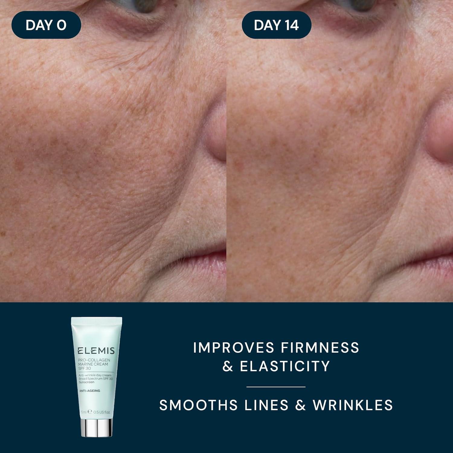 image:imageELEMIS Healthy Skin Exclusive Travel Set ProCollagen Cleansing Balm Mini Marine Cream SPF 30 Mini amp Dynamic Resurfacing Pads AntiAging Hydrating Skincare Travel Kit