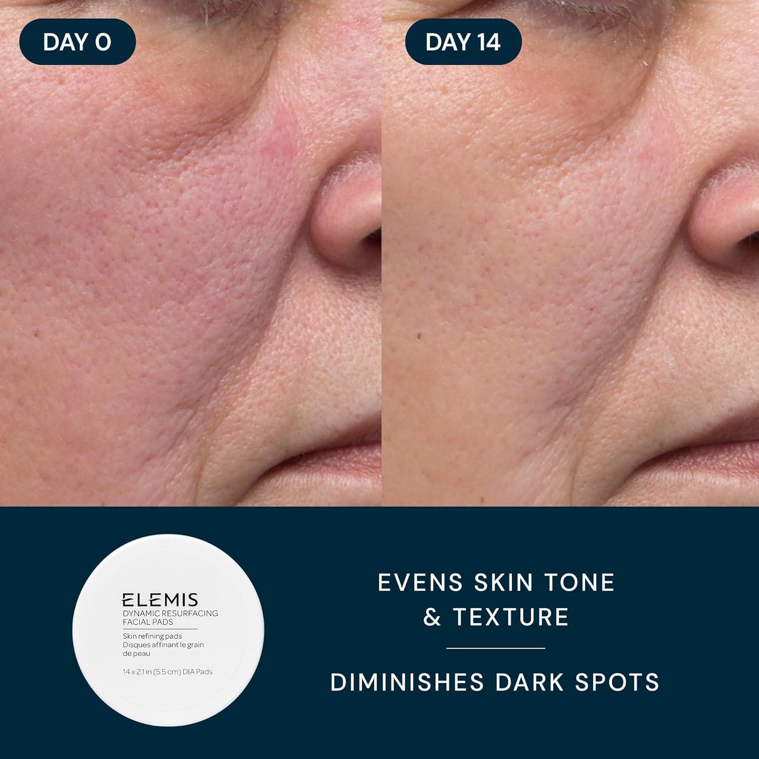 image:imageELEMIS Healthy Skin Exclusive Travel Set ProCollagen Cleansing Balm Mini Marine Cream SPF 30 Mini amp Dynamic Resurfacing Pads AntiAging Hydrating Skincare Travel Kit