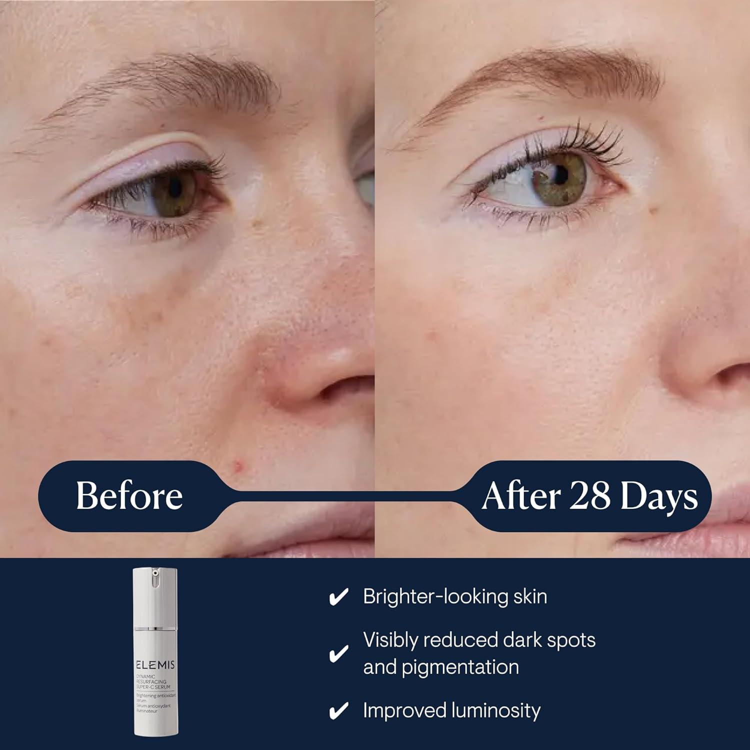 image:imageELEMIS Dynamic Resurfacing SuperC Serum Daily AntiAging Antioxidant Serum Brightens Refines and Illuminates Dull Skin with Vitamin C 30 mL