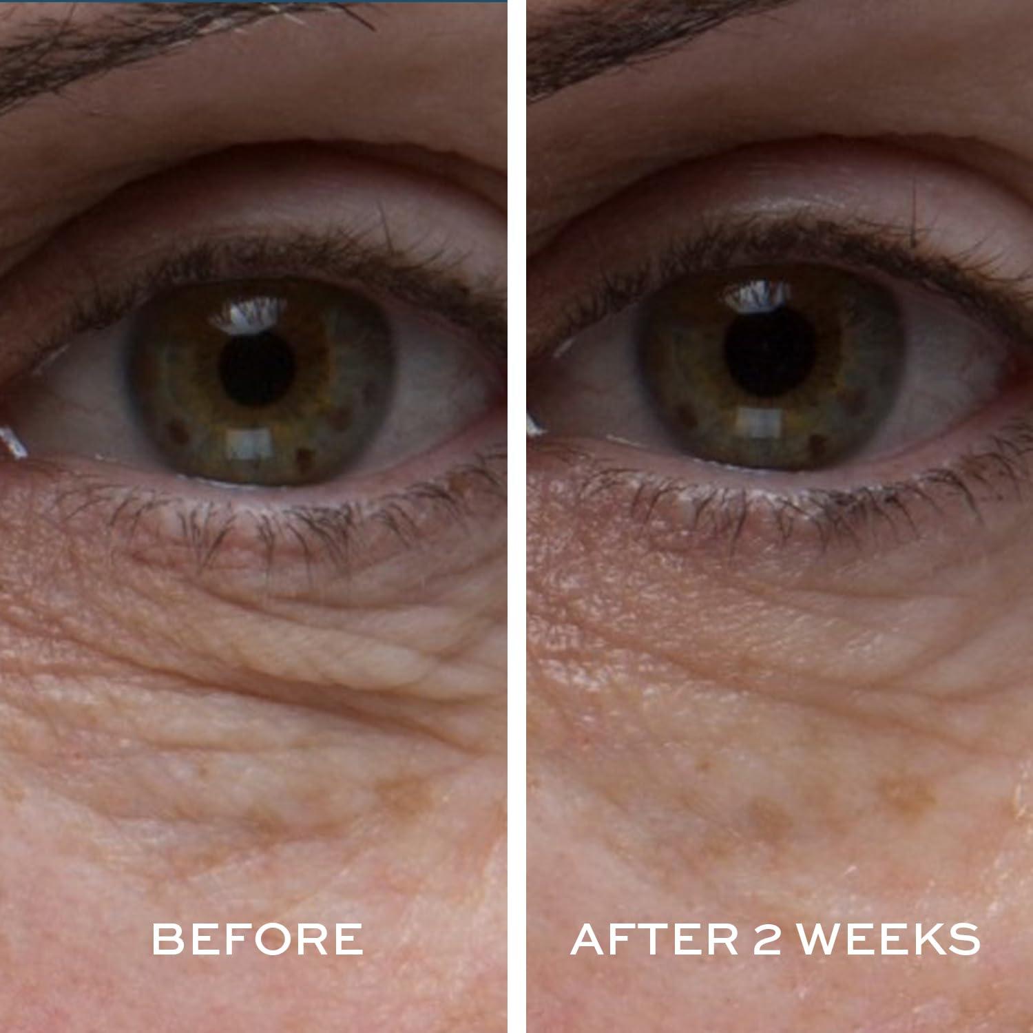 image:imageELEMIS Peptide4 Eye Recovery Cream Reviving Eye Cream 05 Fl Oz