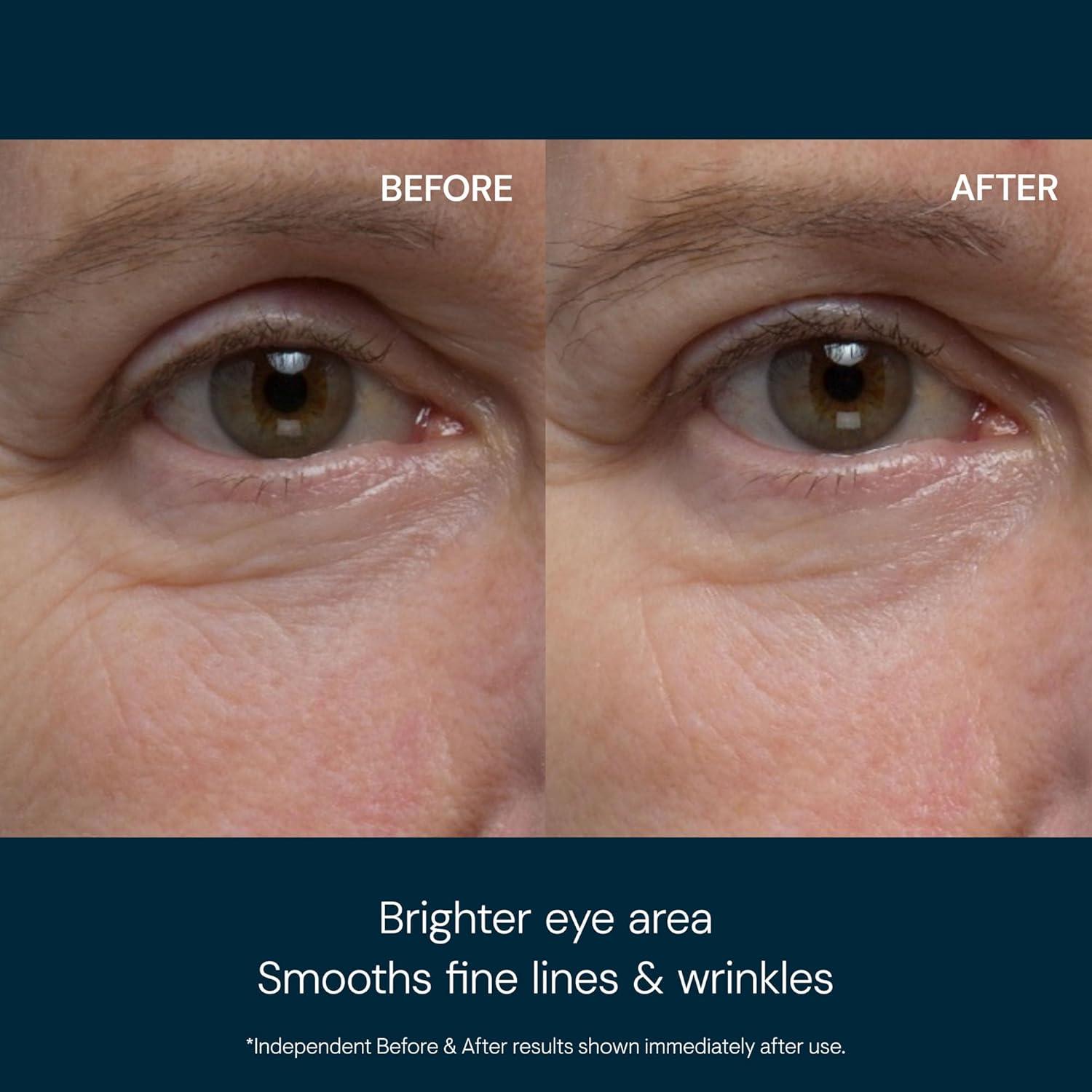 image:imageELEMIS ProCollagen Eye Revive Mask AntiWrinkle MultiUse Treatment Brightens Rejuvenates Plumps and Hydrates for a More Youthful Look05 Fl Oz Pack of 1