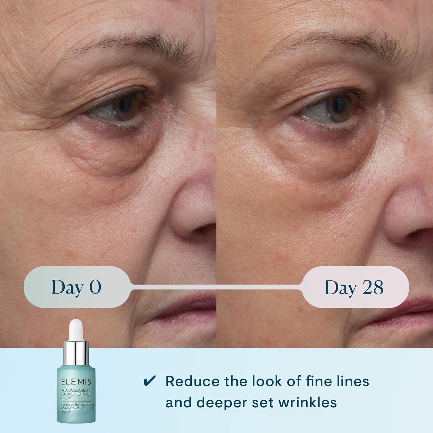 image:imageELEMIS ProCollagen Future Restore Serum Advanced AntiAging Serum to Firm Restore amp Smooth Skin1 Fl Oz Pack of 1