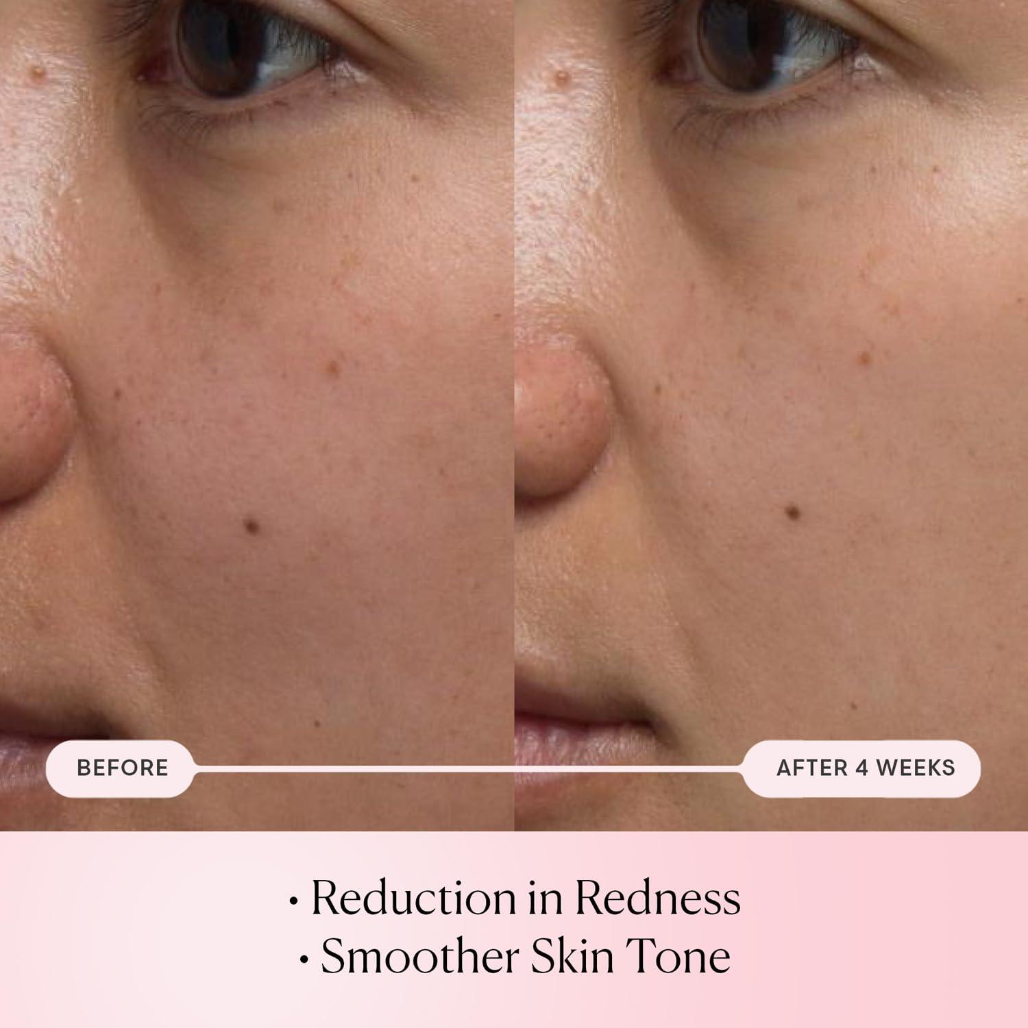 image:imageELEMIS ProCollagen Rose Micro Serum Hydration serum that plumps soothes and nourishes your skin while reducing fine lines amp wrinkles