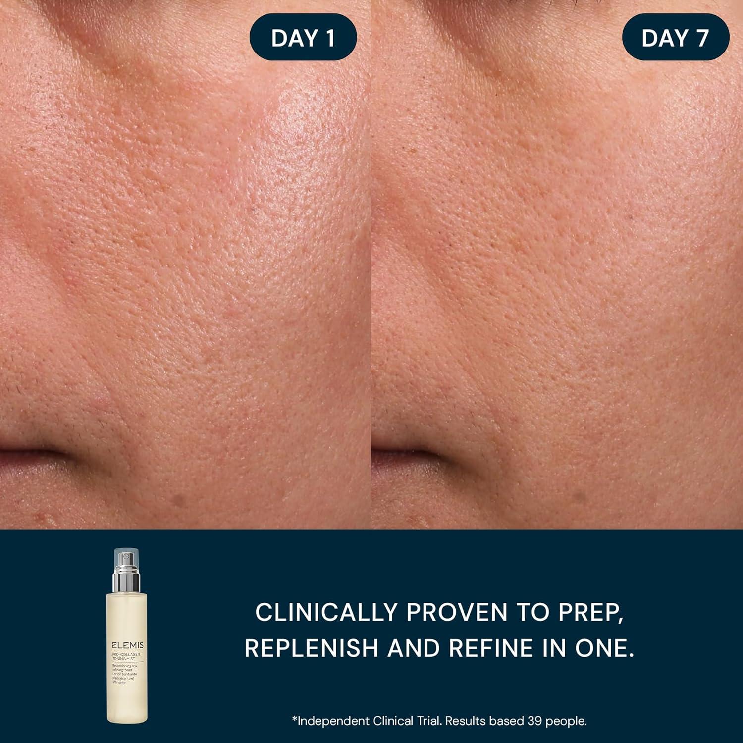 image:imageELEMIS ProCollagen Toning Mist 150ml Hydrating PHA Facial Mist to Refine Pores amp Smooth Skin