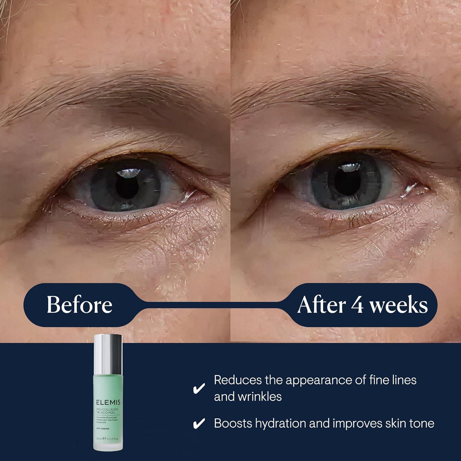 image:imageELEMIS ProCollagen TriAcid Peel 1 fl oz
