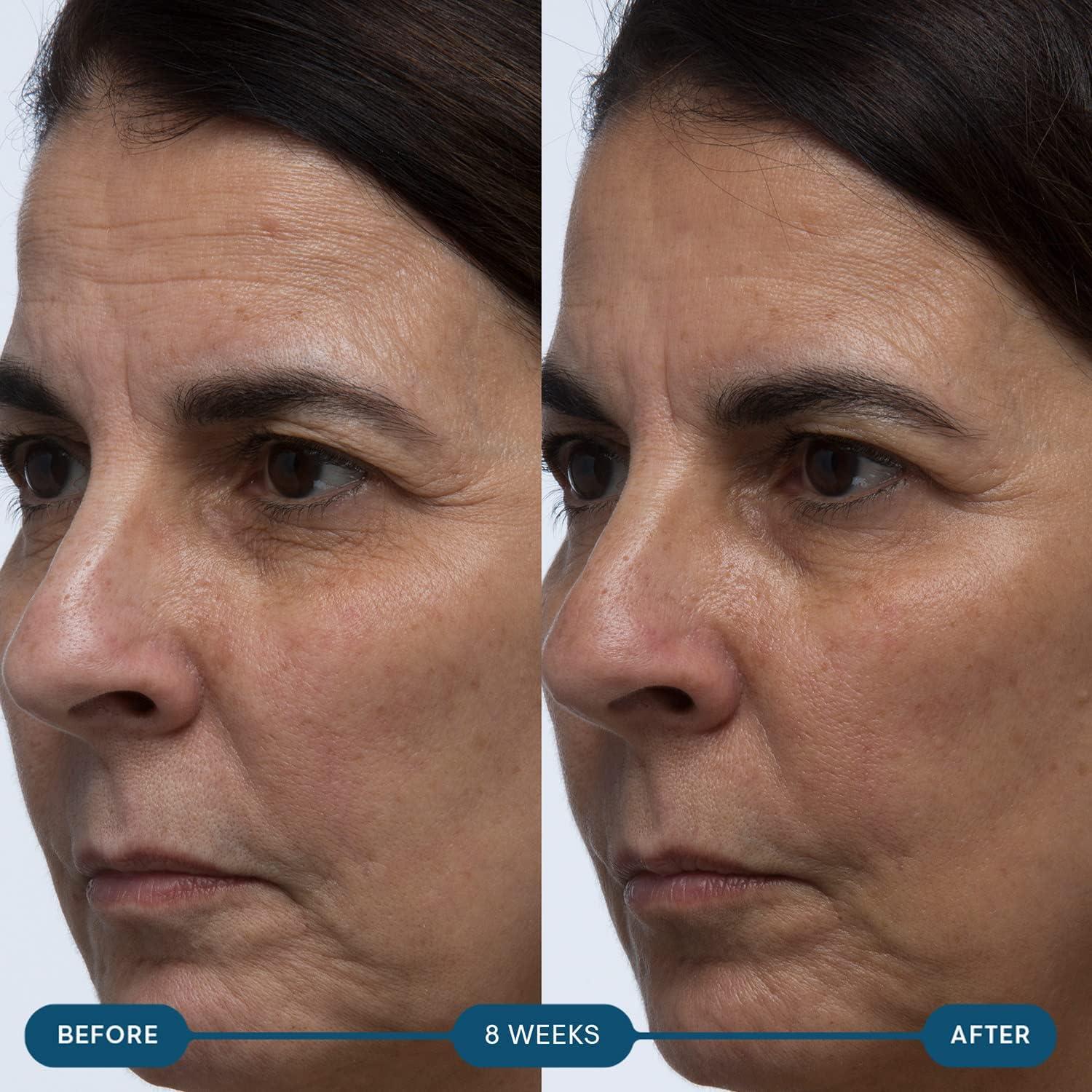 image:imageELEMIS ProCollagen Skin Future Supplements Daily Ingestible Reduces the Look of Fine Lines amp Wrinkles Supports Hydration amp Elasticity 60 Capsules