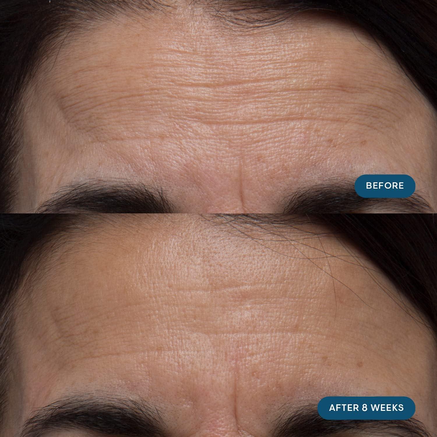 image:imageELEMIS ProCollagen Skin Future Supplements Daily Ingestible Reduces the Look of Fine Lines amp Wrinkles Supports Hydration amp Elasticity 60 Capsules