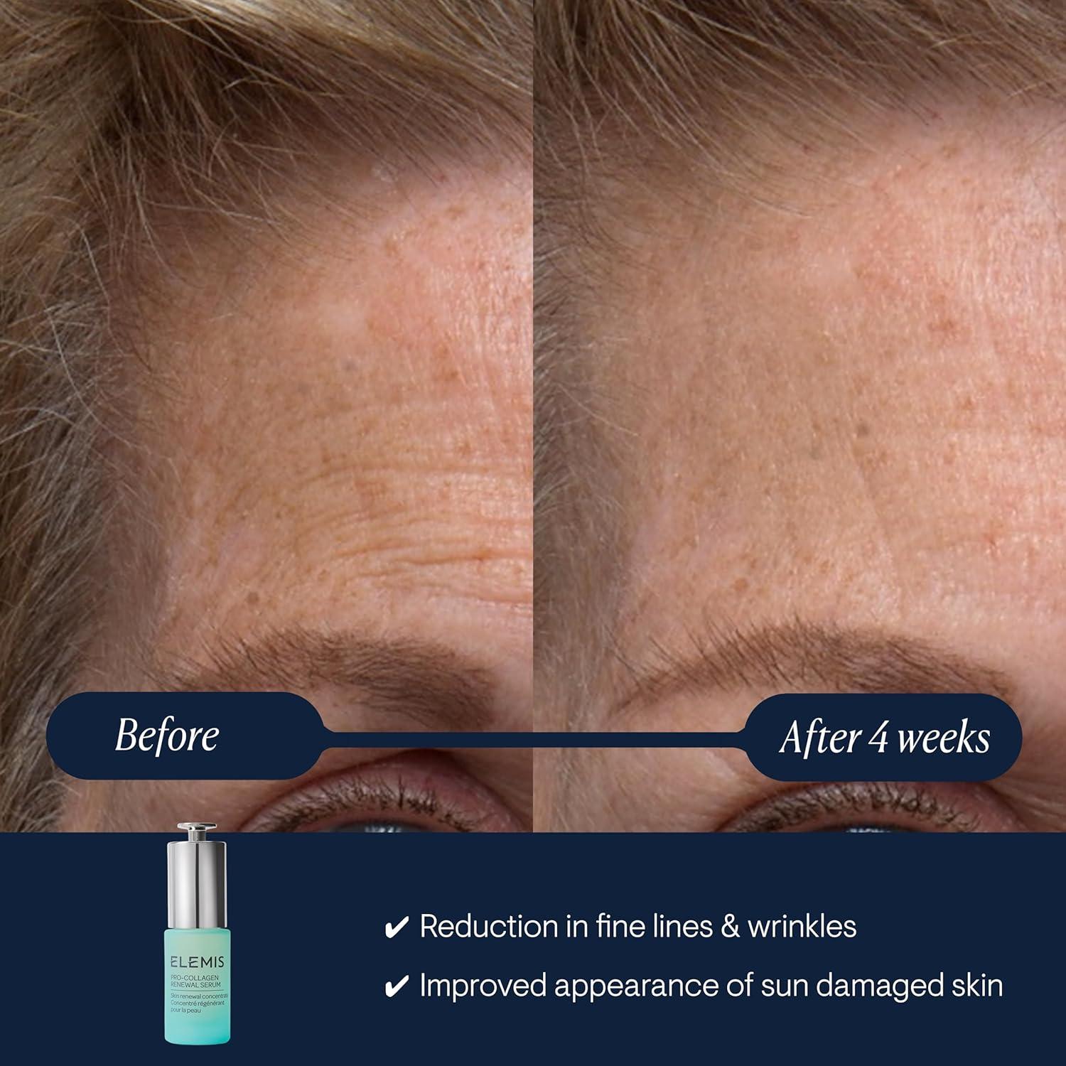 image:imageELEMIS ProCollagen Renewal Serum 15ml Gentle Retinol Alternative for Smoothing Fine Lines amp Wrinkles