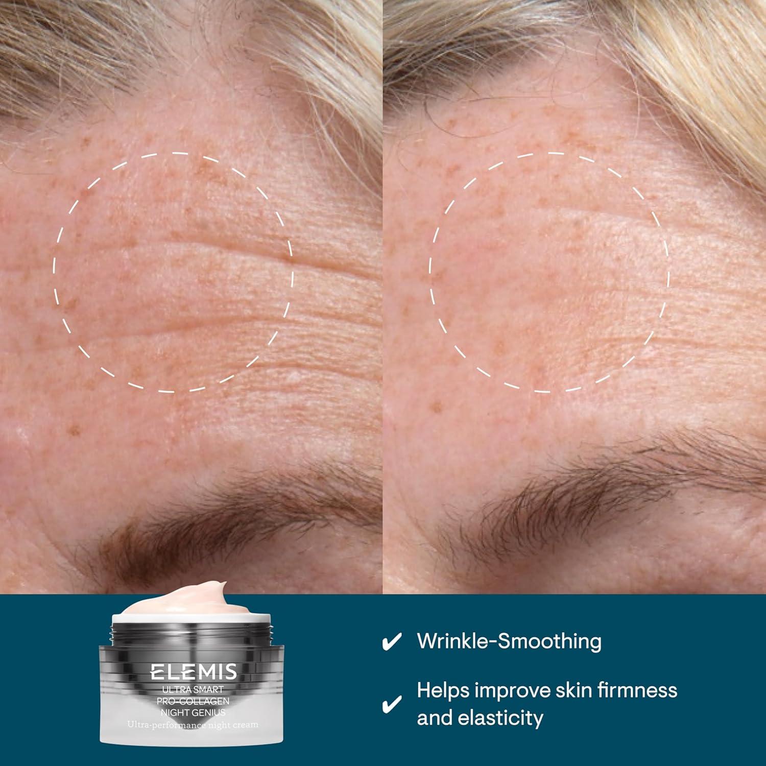 image:imageELEMIS ULTRA SMART ProCollagen Night Genius Powerful AntiWrinkle Rich Recovery Cream Replenishes Rejuvenates and Firms Skin Overnight169 Fl Oz Pack of 1